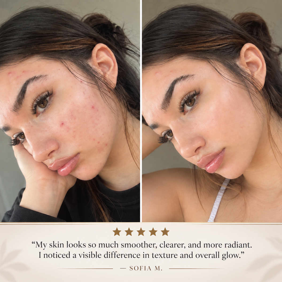 Dark Spot Serum